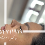 مراقبت های قبل از عمل دکتر اسدالله پور