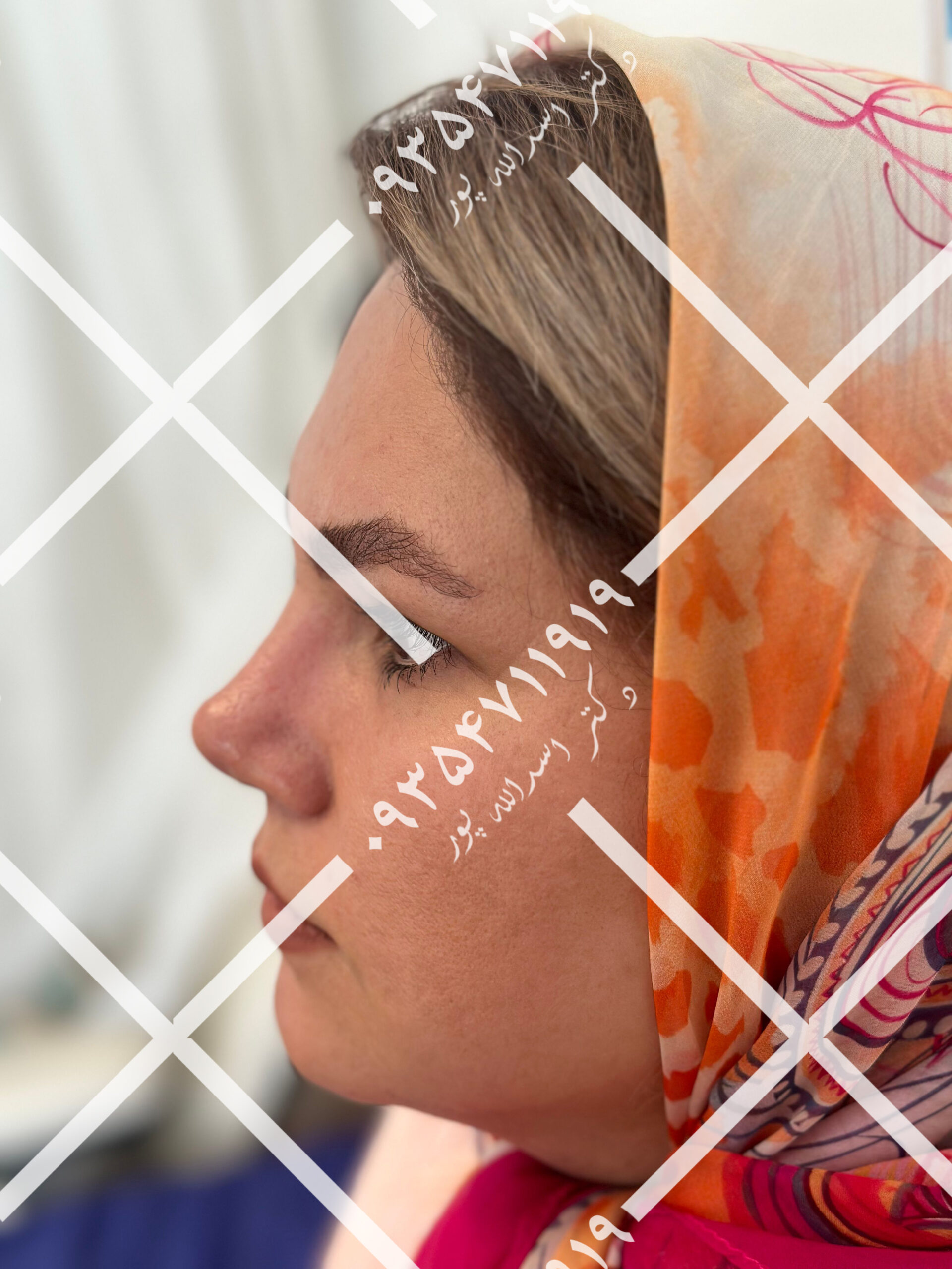 نمونه جراحی دکتر اسدالله پور