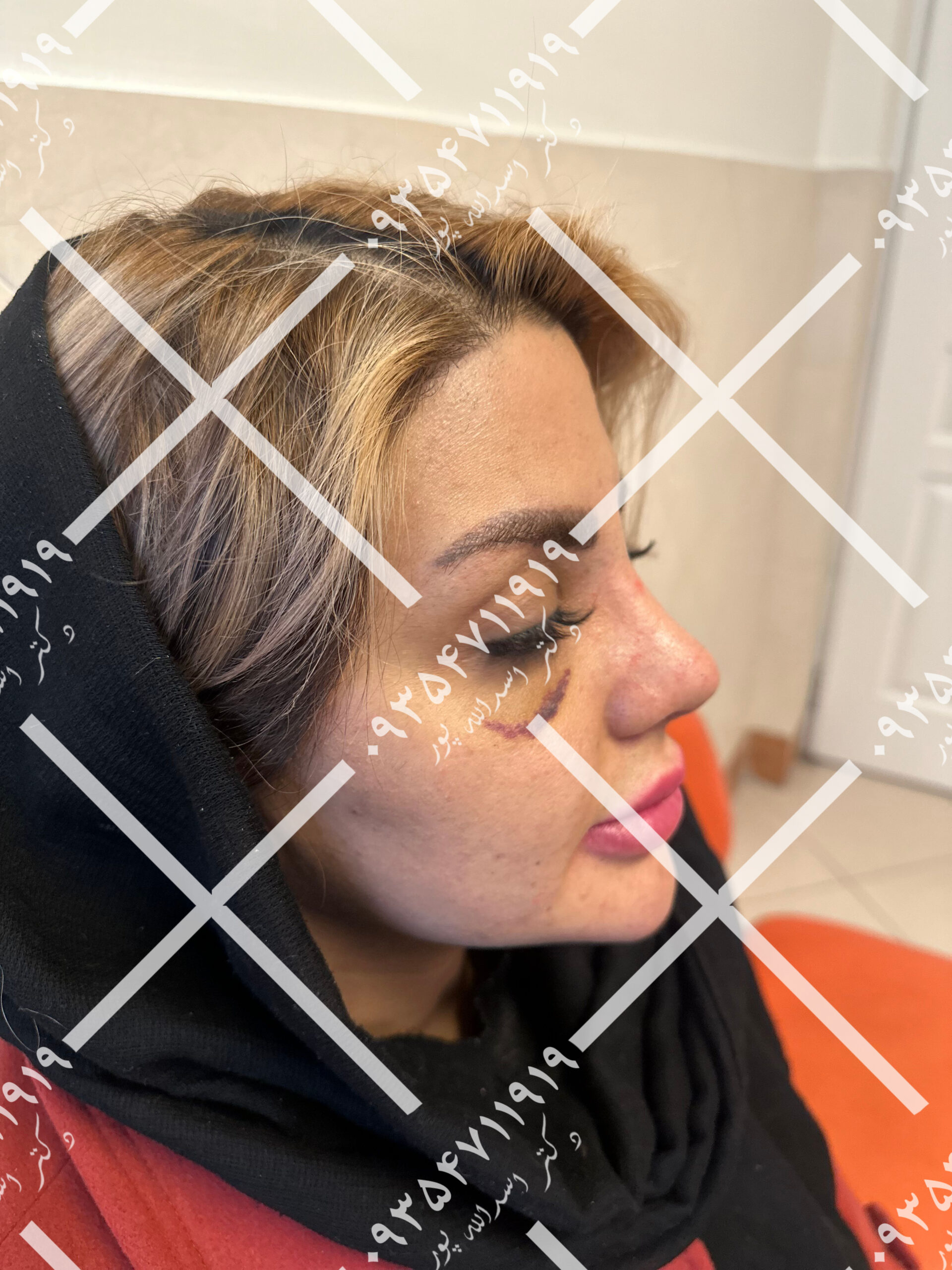 نمونه عمل نیمه فانتزی دکتر اسدالله پور