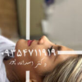 مراقبت های بعد از عمل دکتر اسدالله پور