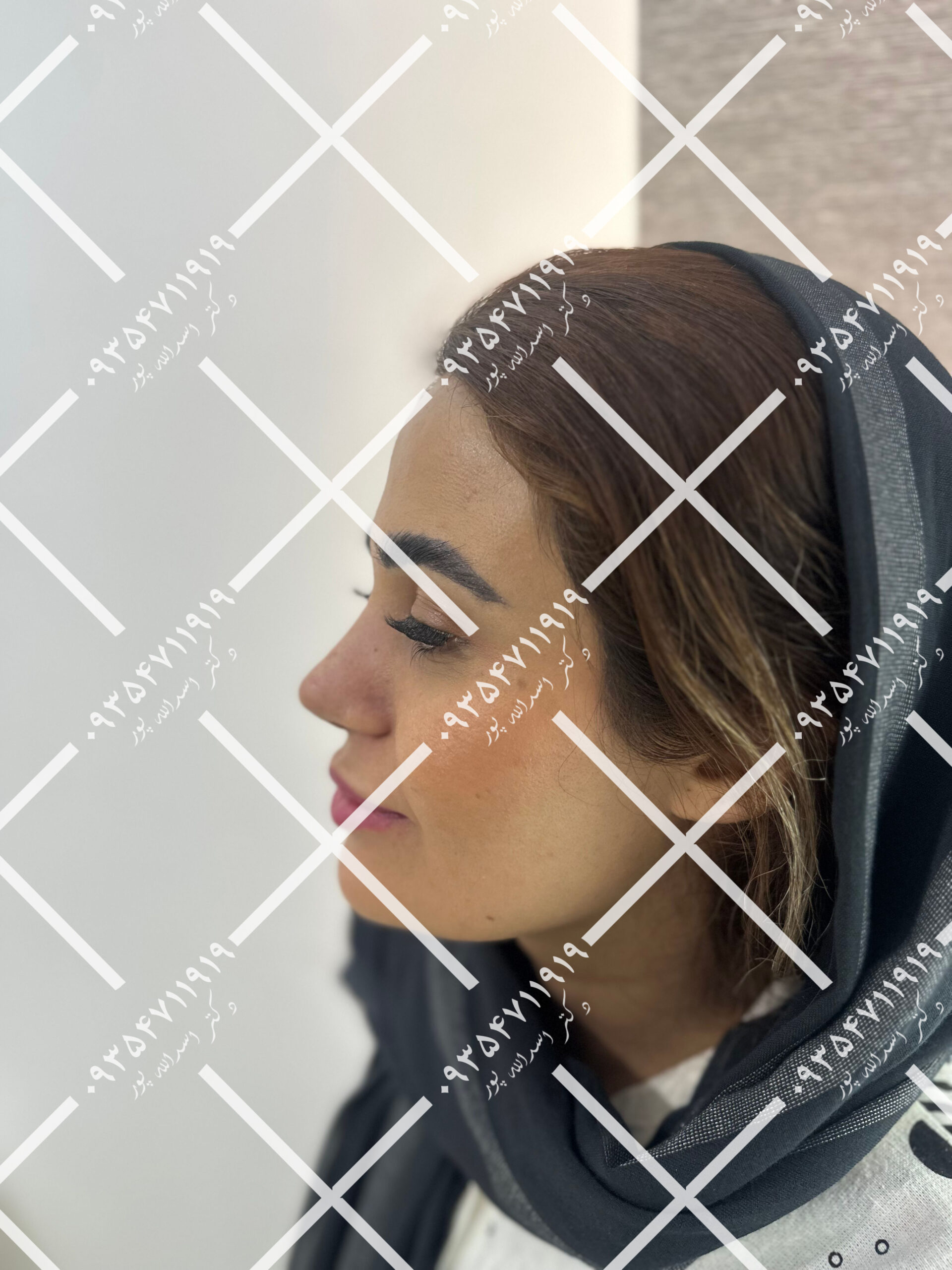 بهترین جراح بینی قائمشهر