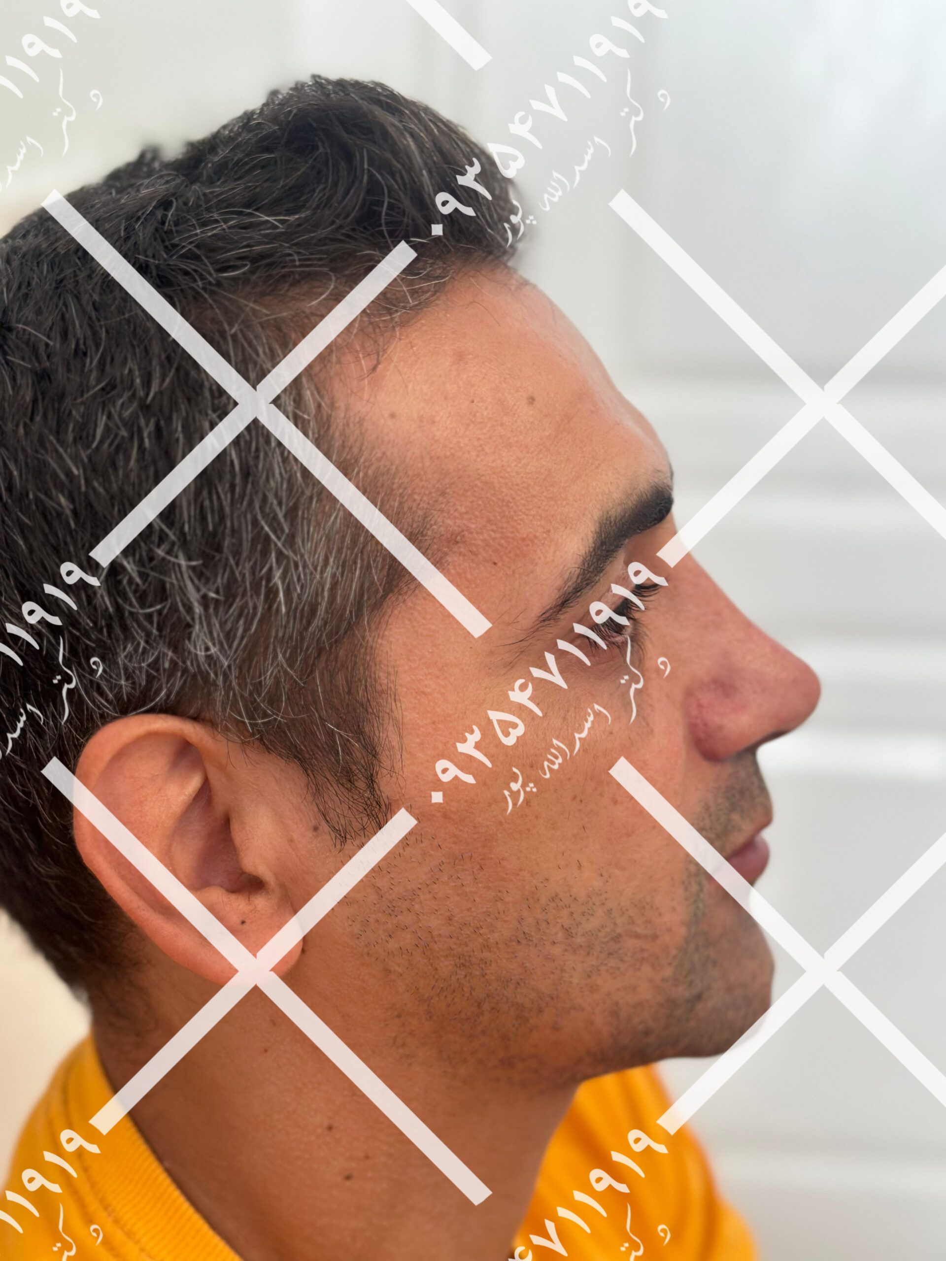 نمونه عمل طبیعی دکتر اسدالله پور